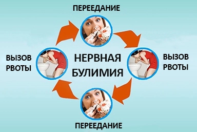 Лечение булимии в Каслях